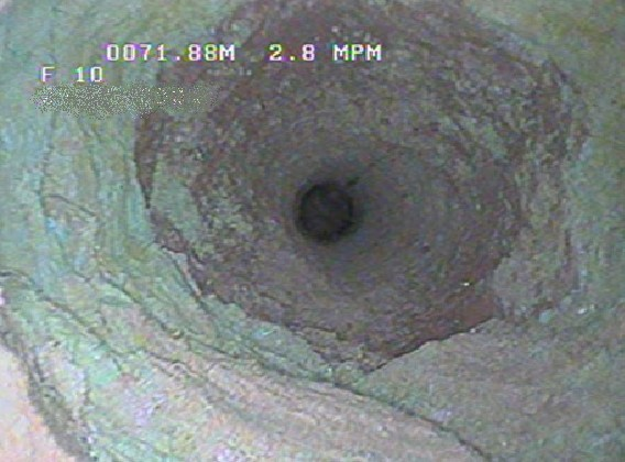 Auscultation par caméra-vidéo