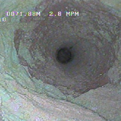 Auscultation par caméra-vidéo